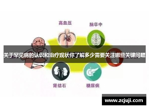 关于罕见病的认识和治疗现状你了解多少需要关注哪些关键问题